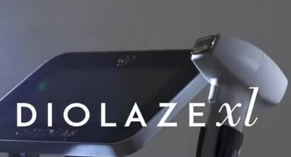 Diolzae laser hair removal services in tuscola and abilene, tx