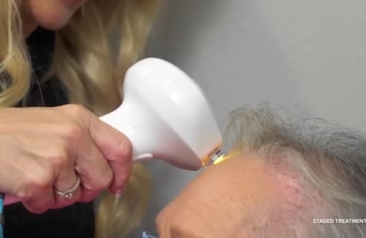 Lumecca light therapy treatment being administered in Tuscola and Abilene, TX